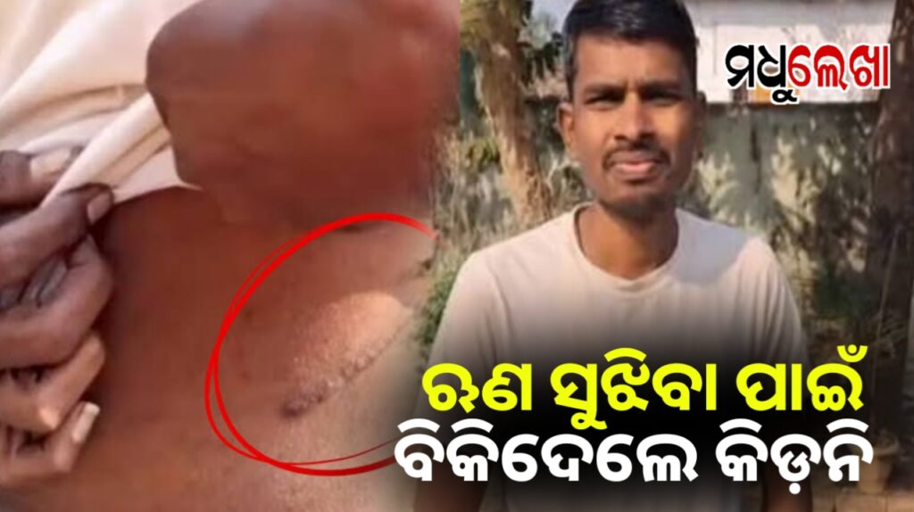 ଋଣ ବୋଝରେ ଚାପି ହୋଇ କିଡନି ବିକ୍ରି କଲେ ଜଣେ ଚାଷୀ